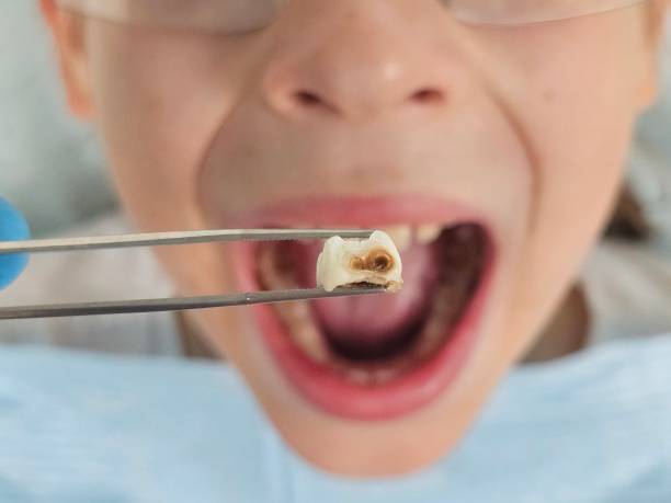Best Dental Abscess Treatment in Hoxie, KS